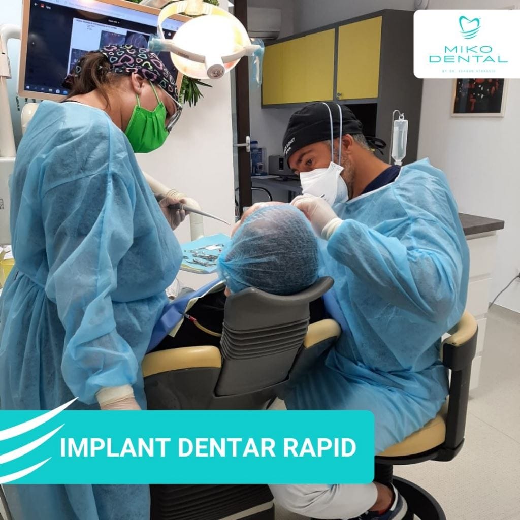 Implant dentar rapid