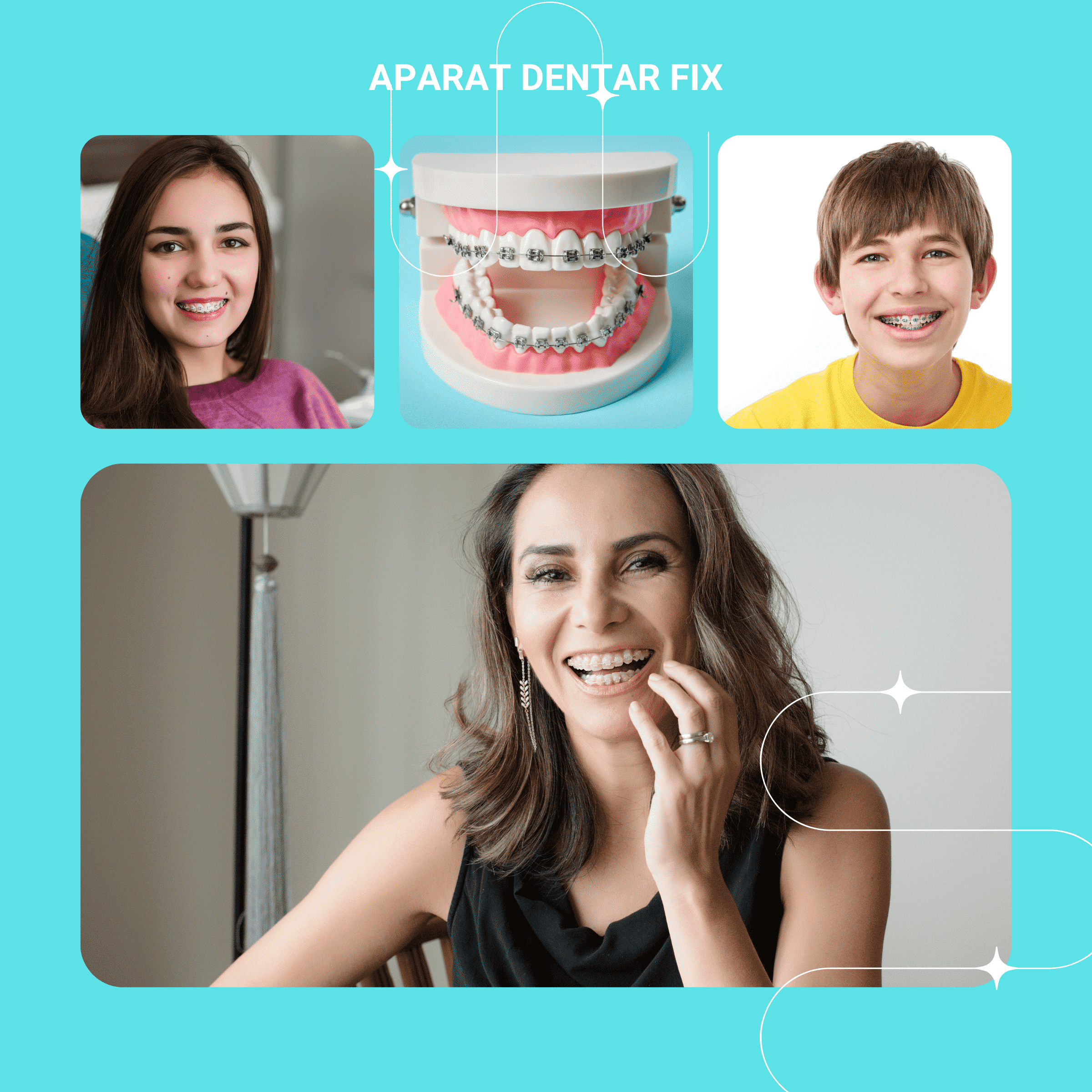 Aparat dentar fix visual
