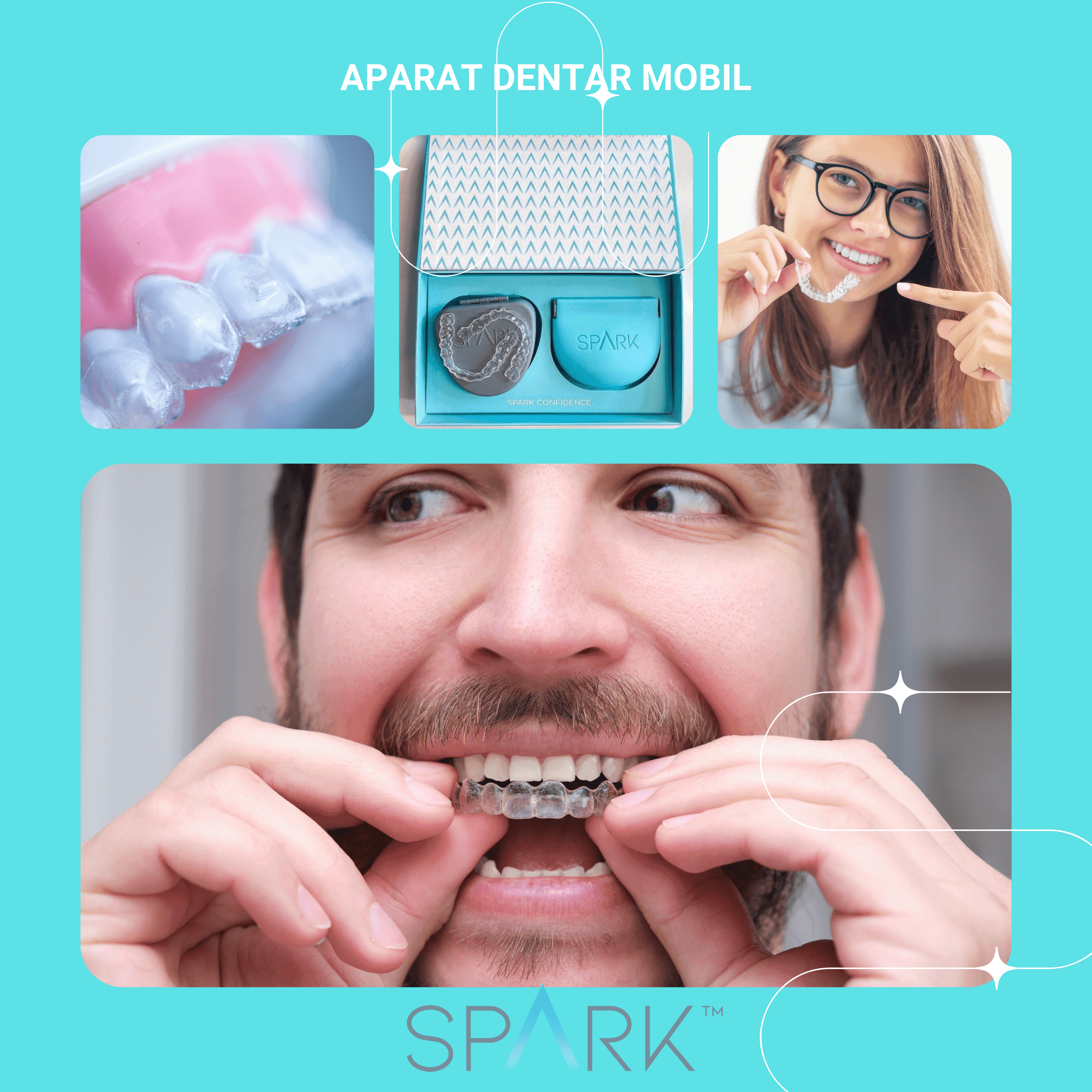 Aparat dentar mobil visual