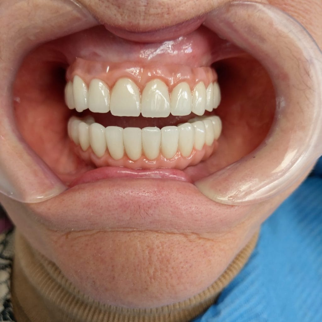 Miko Dental