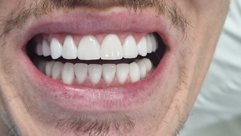 Miko Dental