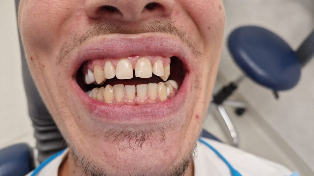 Miko Dental