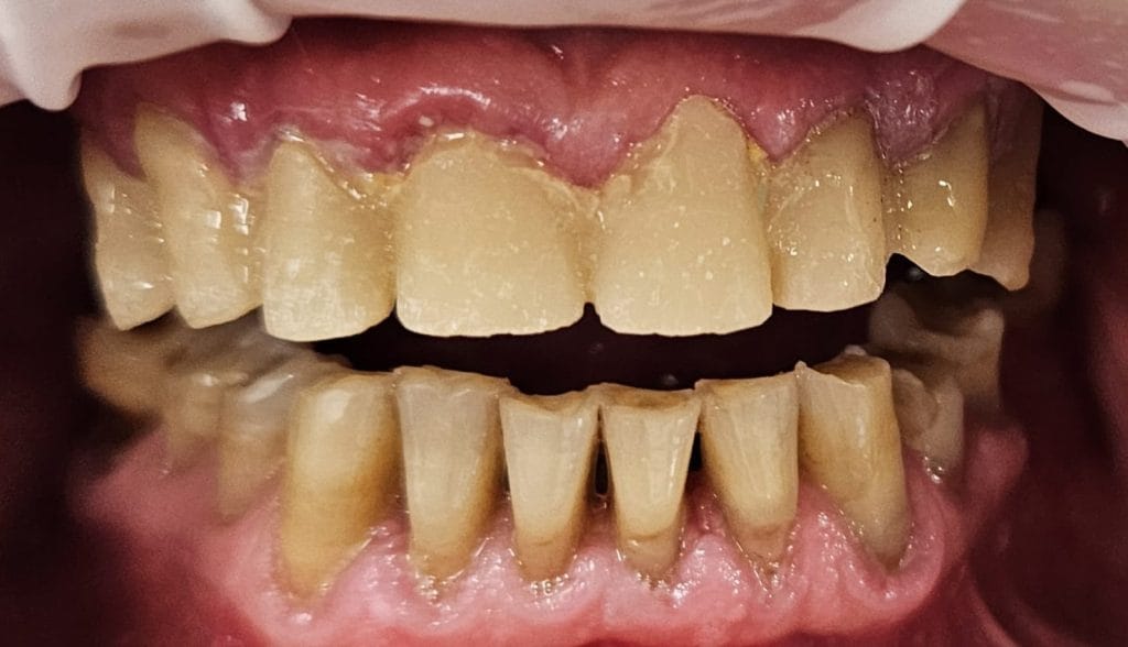 Miko Dental