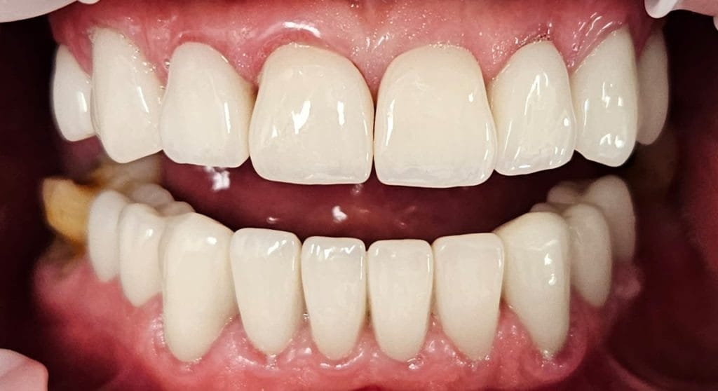 Miko Dental