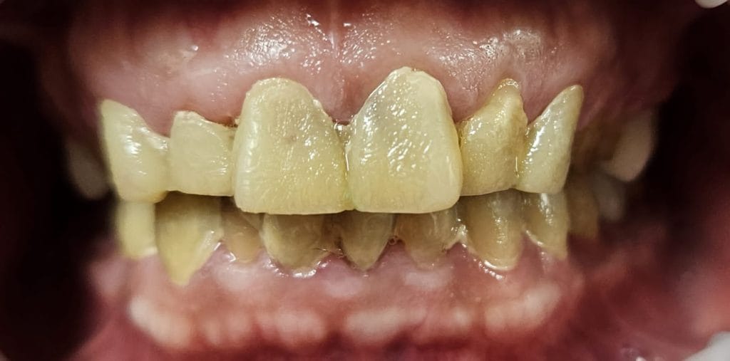 Miko Dental