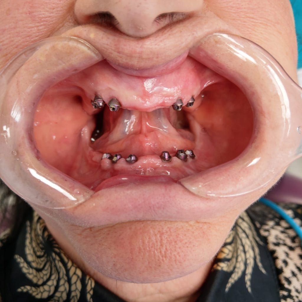Miko Dental