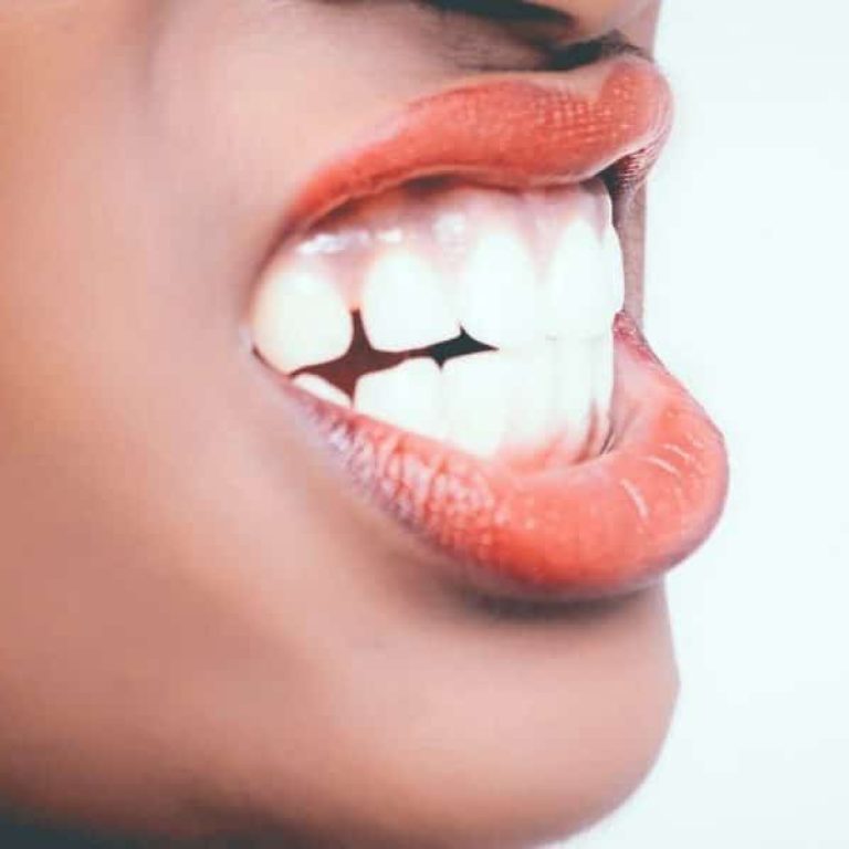 cauze bruxism