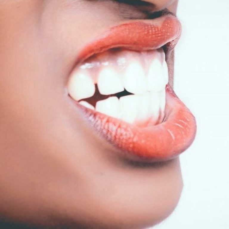 Bruxism